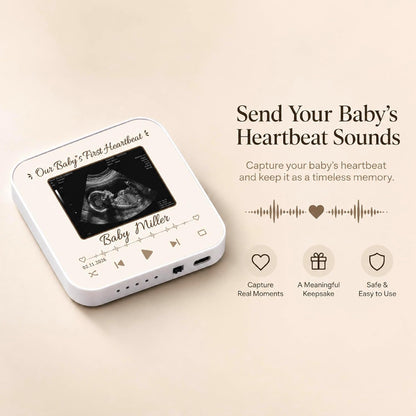 Custom Baby Heartbeat Music Fridge Magnet with Ultrasound Photo and Name