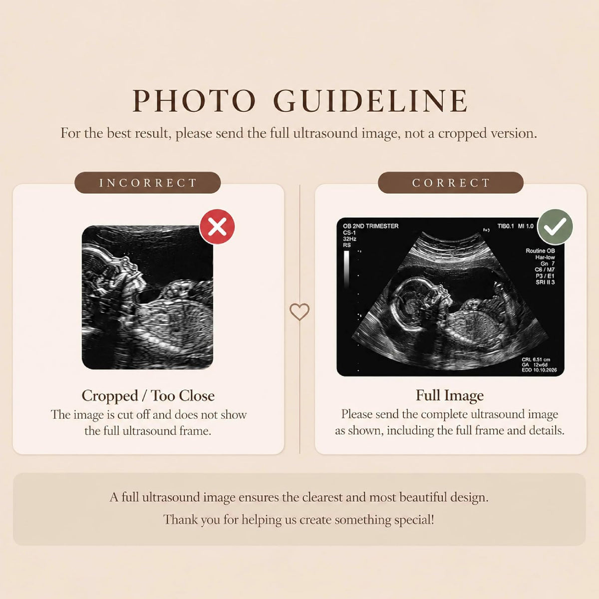 Custom Baby Heartbeat Music Fridge Magnet with Ultrasound Photo and Name